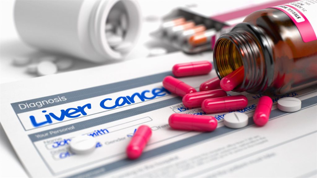 Liver Cancer Rates Continue to Increase