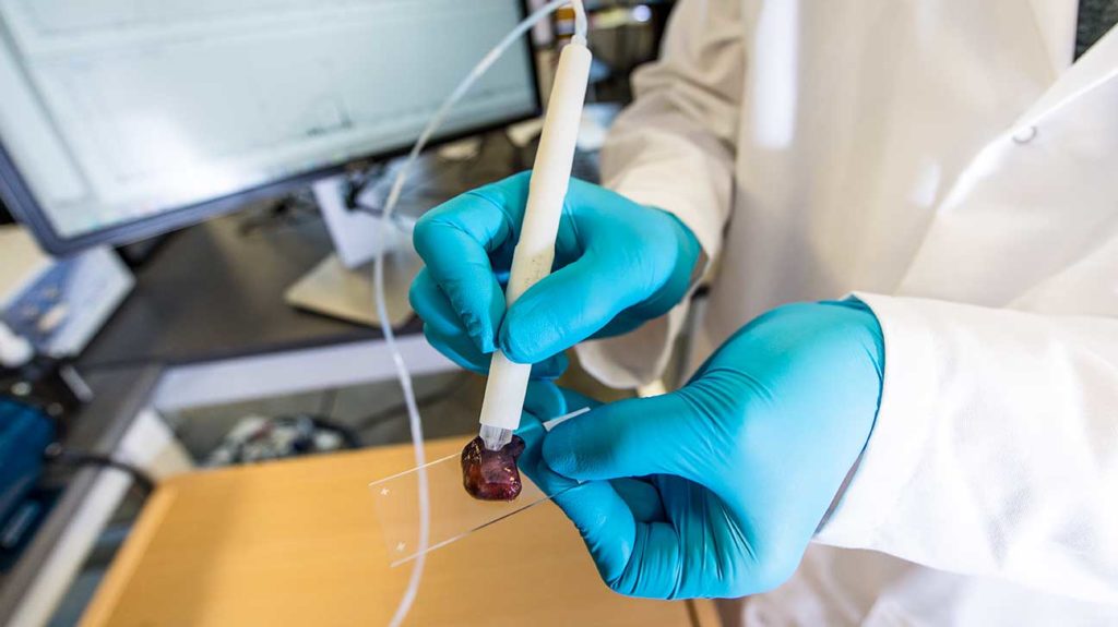 Cancer Pen Testing Tissue Sample